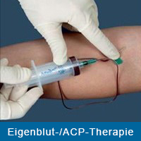 Eigenblut-/ACP-Therapie