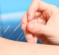 Akupunkturbehandlungen