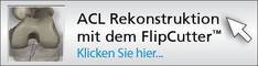 oi acl rekonstruktion kreuzband