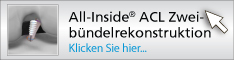 oi zweibuendelrekonstruktion kreuzband