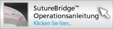 suturebridge
